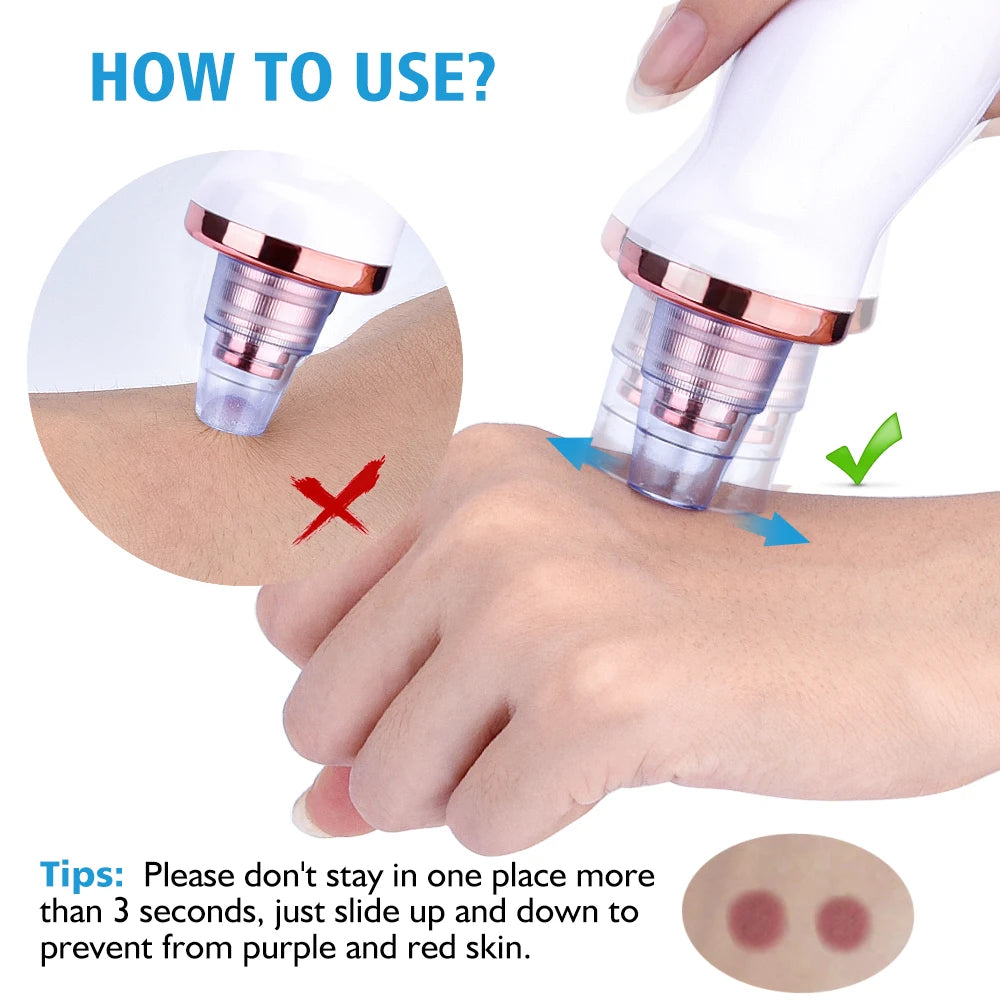 Vacuum Blackhead Removal Facial Cleansing Black Spots Suction Acne Pimple Remover Beauty Instrument USB Charge Skincare Tools
