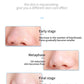 Vacuum Blackhead Remover Pore Cleaner Comedo Microdermabrasion Face Pore Cleaning Blackhead Suction Machine